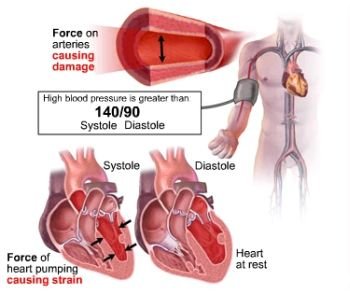 diastolic blood pressure2