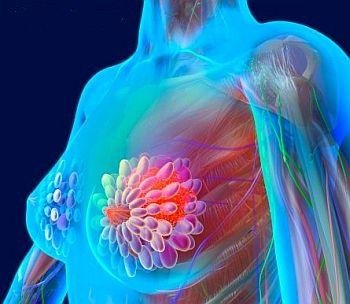 (16) How is chemotherapy given?