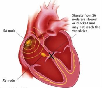 (37) Heart Attack and Cardiac Disorders