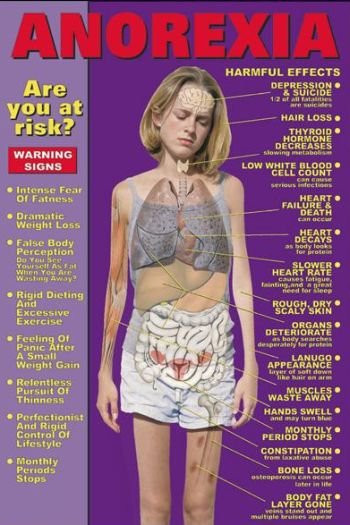 (35) Anorexia