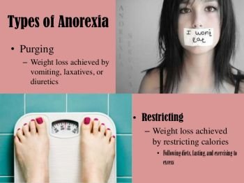 (38) Anorexia
