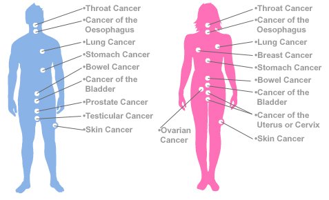 (12) Cancer Symptoms & Treatment