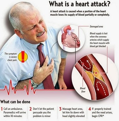(41) Heart Attack and Cardiac Disorders