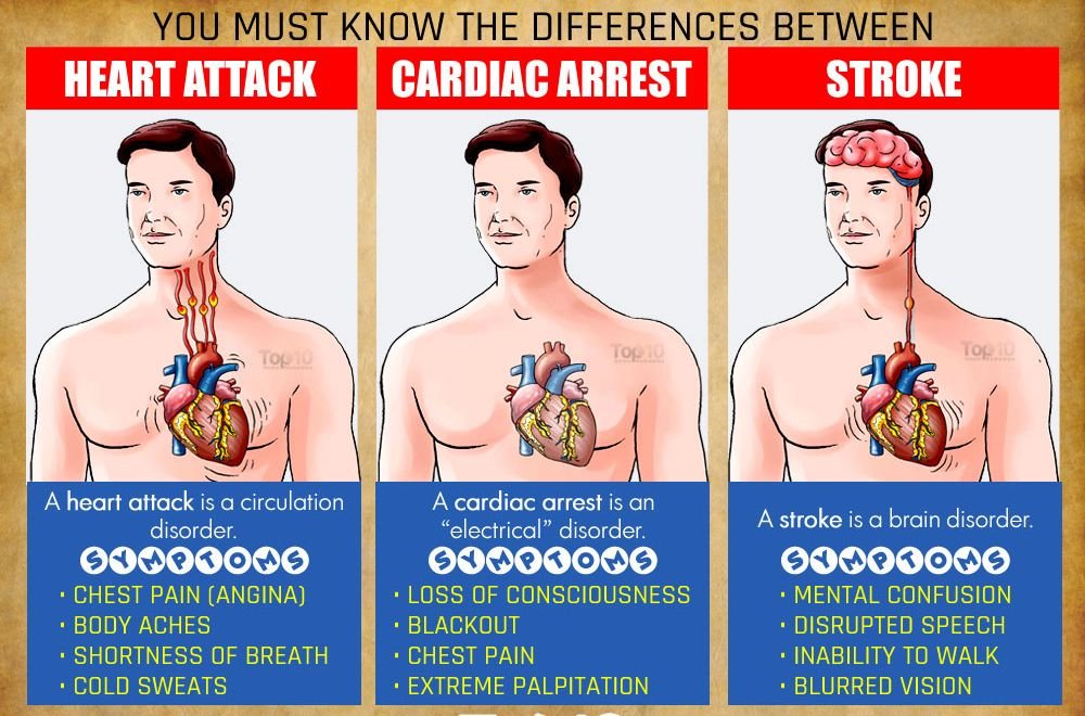 (45) Heart Attack and Cardiac Disorders