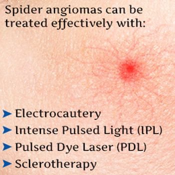 (25)  Skin Disorders