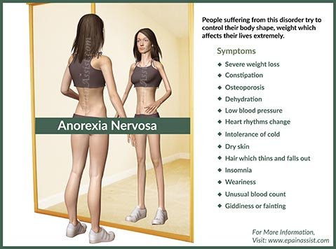 (44) Anorexia
